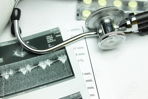 Black stethoscope, yellow tablets and the results of echocardiography 