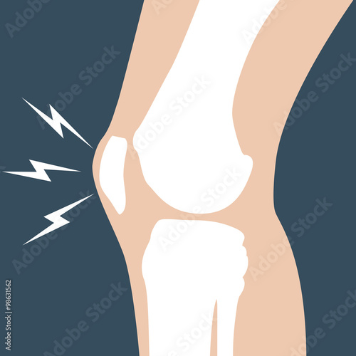 Knee pain - joint bones, orthopedic