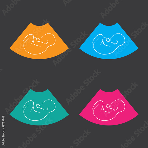 Ultrasonic picture of unborn baby