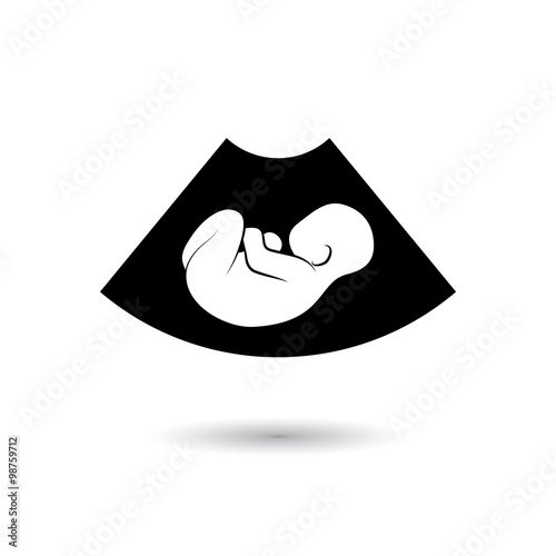 Ultrasonic picture of unborn baby