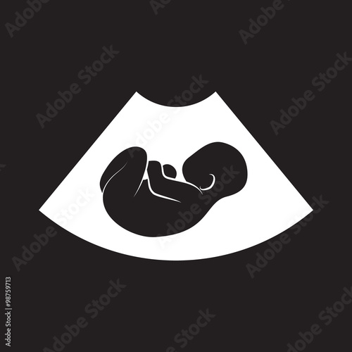 Ultrasonic picture of unborn baby