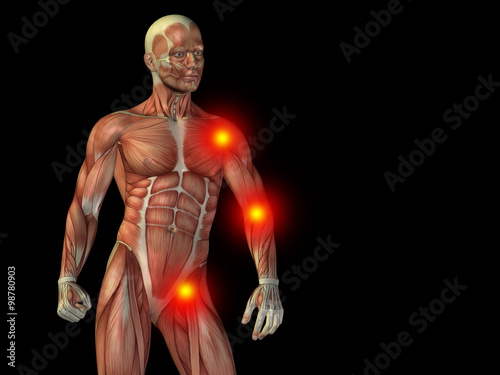Conceptual human body anatomy pain on black