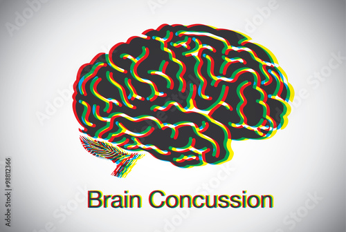Brain shaking until look like many brain overlap meaning to concussion symptom of brain. This illustration about medical and symptom. 