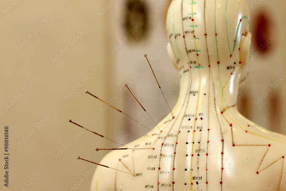 Akupunktur als Alternativmedizin - obrazy, fototapety, plakaty 