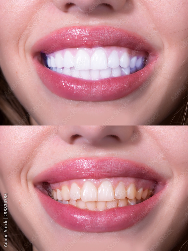 Dental female smile Dental female smile