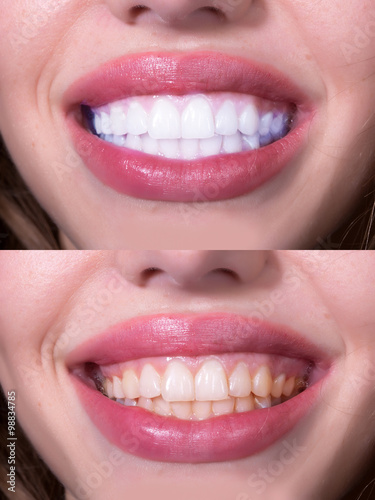 Dental female smile