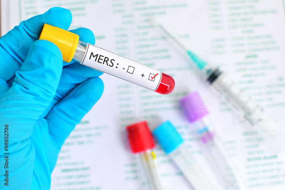 Naklejka premium MERS virus positive