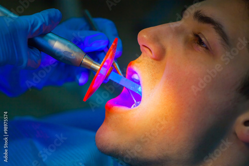 Dentist ultraviolet light equipment. dental treatment. Men photo