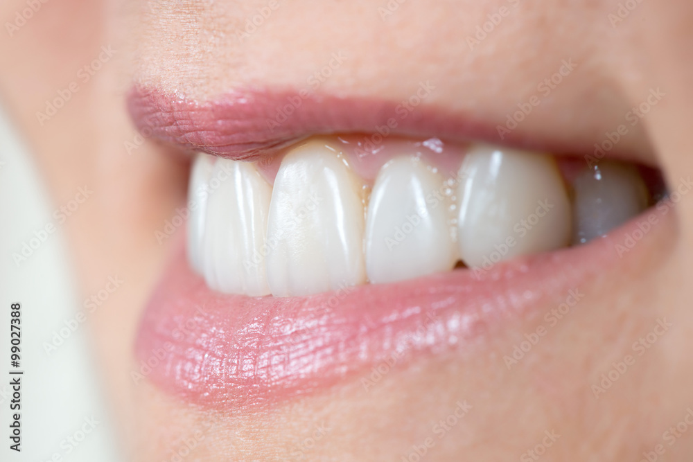 Obraz premium close up of a mouth and restored teeth