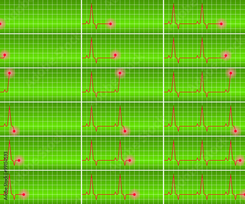 vector set cardiogram