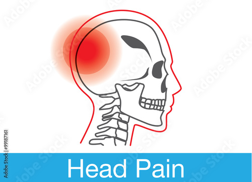 Red warning sign on human skull area that meaning have head pain or injuries at skull. This illustration about symptom, disease and medical.