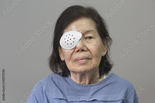 Eye shield covering after cataract surgery.
