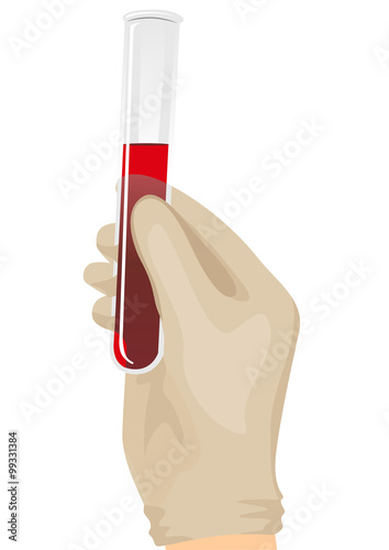 hand holding a test tube filled with blood