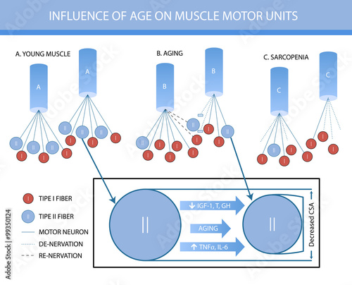 Infographics: influence of age on muscle motor units photo