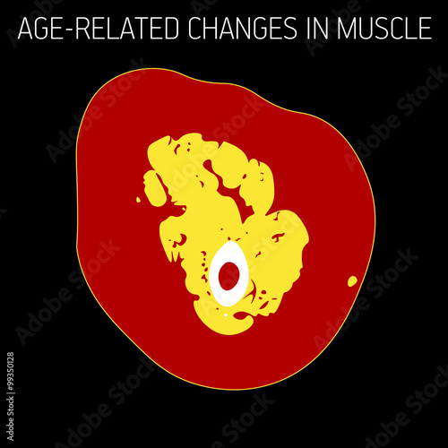 Age-related changes in muscle