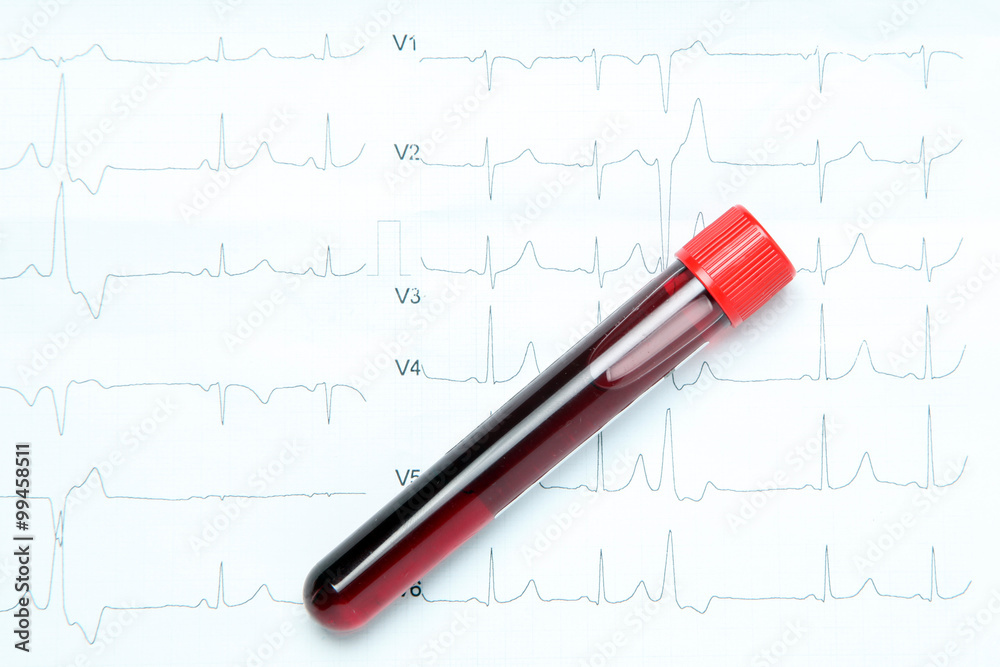Blood Sample Blood Sample