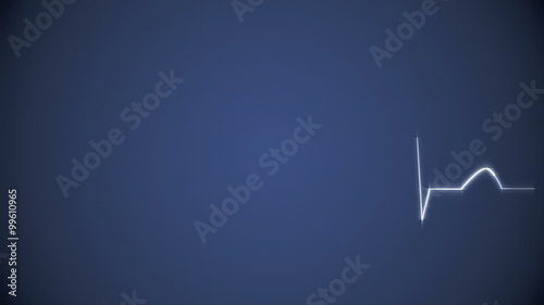 Abstract Heart Beat Cardiogram on Blue Background. Animated Seamless Looping Motion Design. 4K & HD Footage Clip.