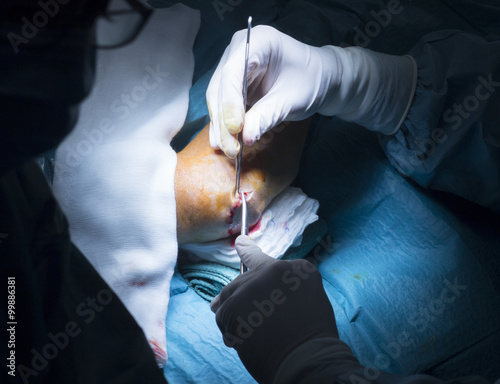 Hospital elbow orthopedics surgery operation