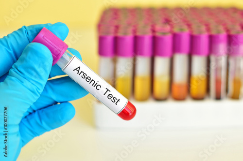Blood sample for arsenic (As) metal test