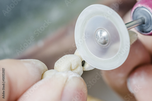Dental technician working with diamond discs.