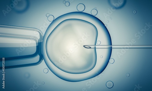 IVF (in vitro fertilisation) or insemination of female egg with microscope. Digital illustration. photo