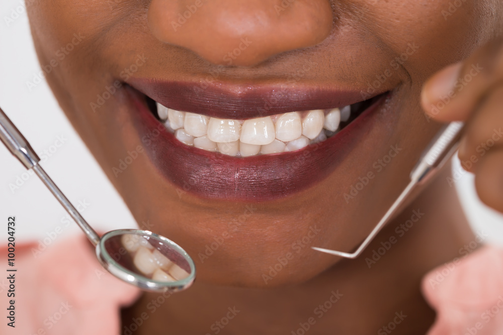 Obraz premium Woman Examining Her Teeth