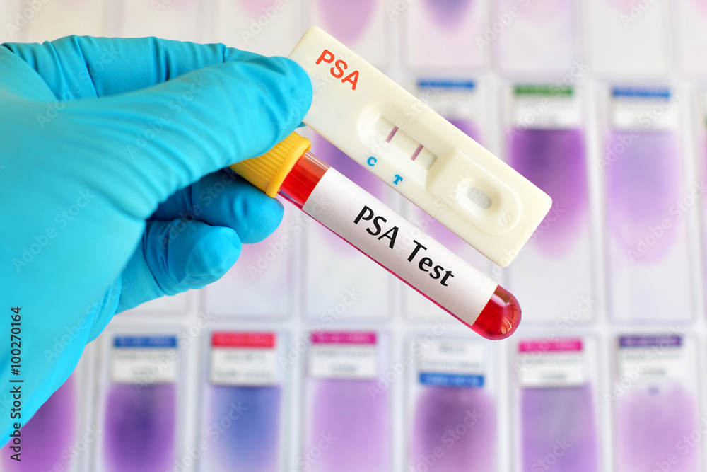 PSA testing PSA testing
