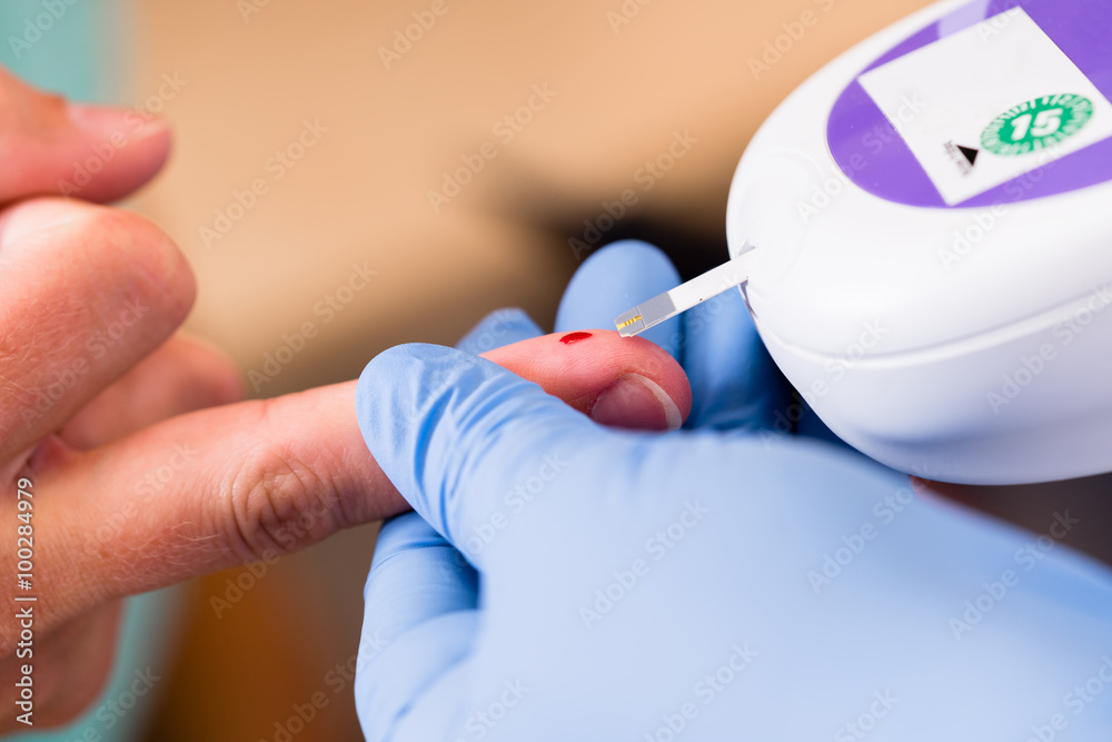 Test Auf Diabetes Beim Arzt