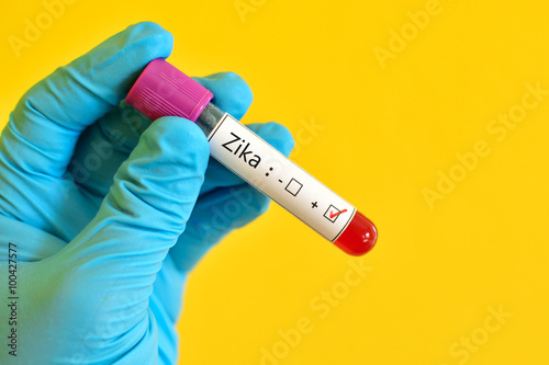 Foto Blood sample positive with Zika virus