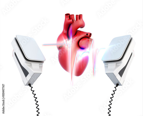 Conceptual image of the model heart and the discharge of defibri