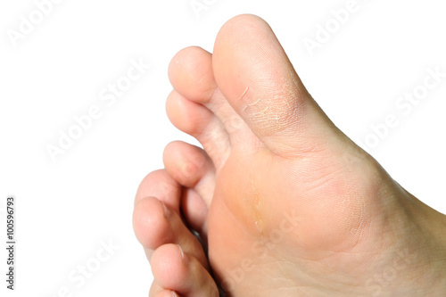 Women s feet dry On a white background