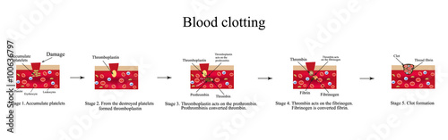 Blood clotting. Infographics. Vector illustration photo