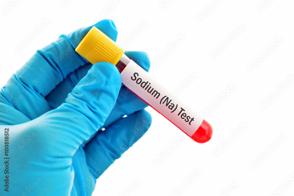 Obraz premium Blood sample for sodium (Na) test