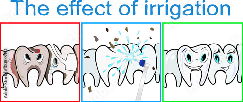 effect of teeth irrigation