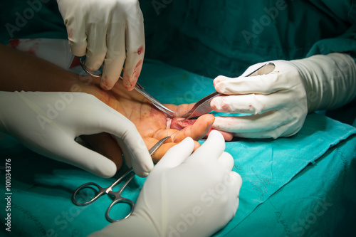 hand surgery