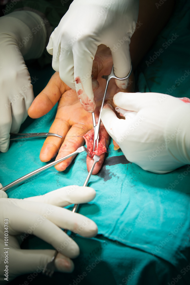 hand surgery hand surgery