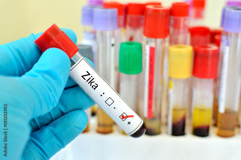 Blood sample positive with Zika virus
