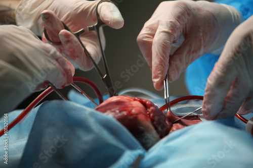 Doctor doing heart operation photo