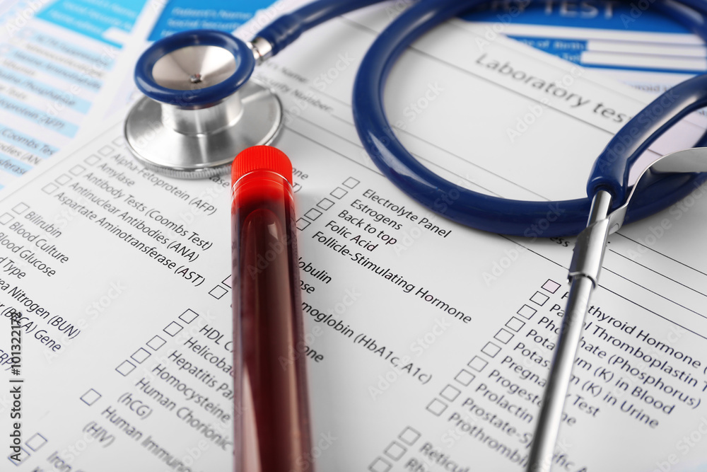 Blood in test tubes, stethoscope and investigation form on the table, close-up Blood in test tubes, stethoscope and investigation form on the table, close-up