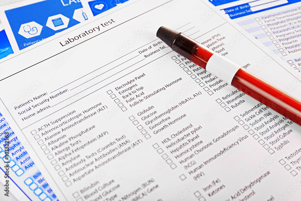 Blood in test tubes and investigation form on the table, close-up Blood in test tubes and investigation form on the table, close-up