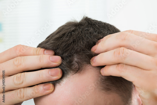 Man Checking Hairline At Home