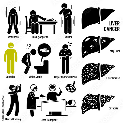 Liver Cancer Symptoms Causes Risk Factors Diagnosis Stick Figure Pictogram Icons