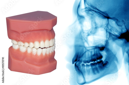 teeth model and x-ray isolated on withe
