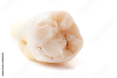 Extracted wisdom tooth, isolated