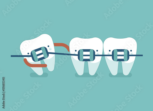 Braces teeth of dental healthcare ,dental concept