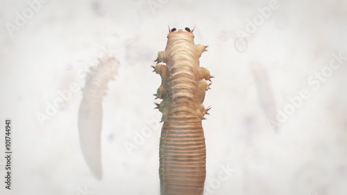 Demodex Folliculorum. Demodicosis - also called demodectic mange or red mange. Demodex Lives in the hair follicles at the base of eyelashes. Human Skin Parasites.
