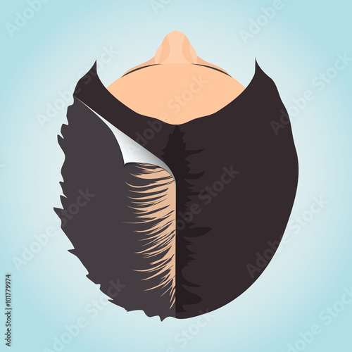 Top view of a woman losing hair before and after hair treatment. Divided image of a woman's head. Two halves. Sticker revealing healthy hair. Female hair loss. Isolated vector illustration.