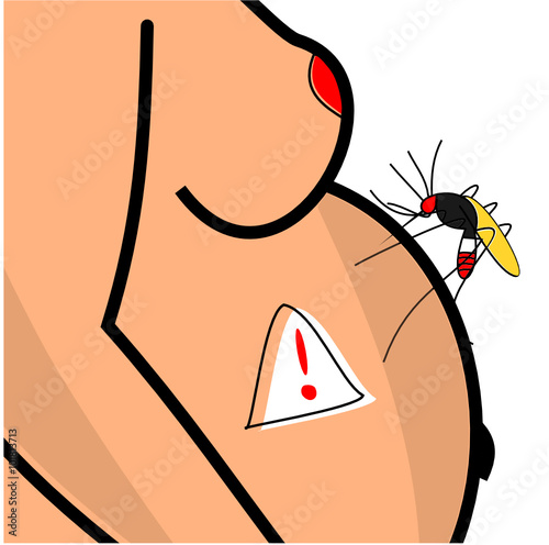 Zika, danger pour les femmes enceintes