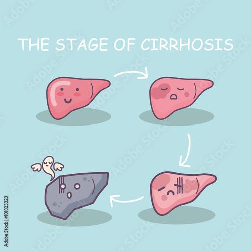 Health liver vs cirrhosis liver