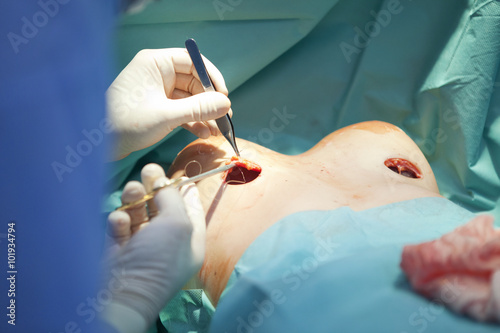 breast augmentation surgery in the operating room surgeon tools implant